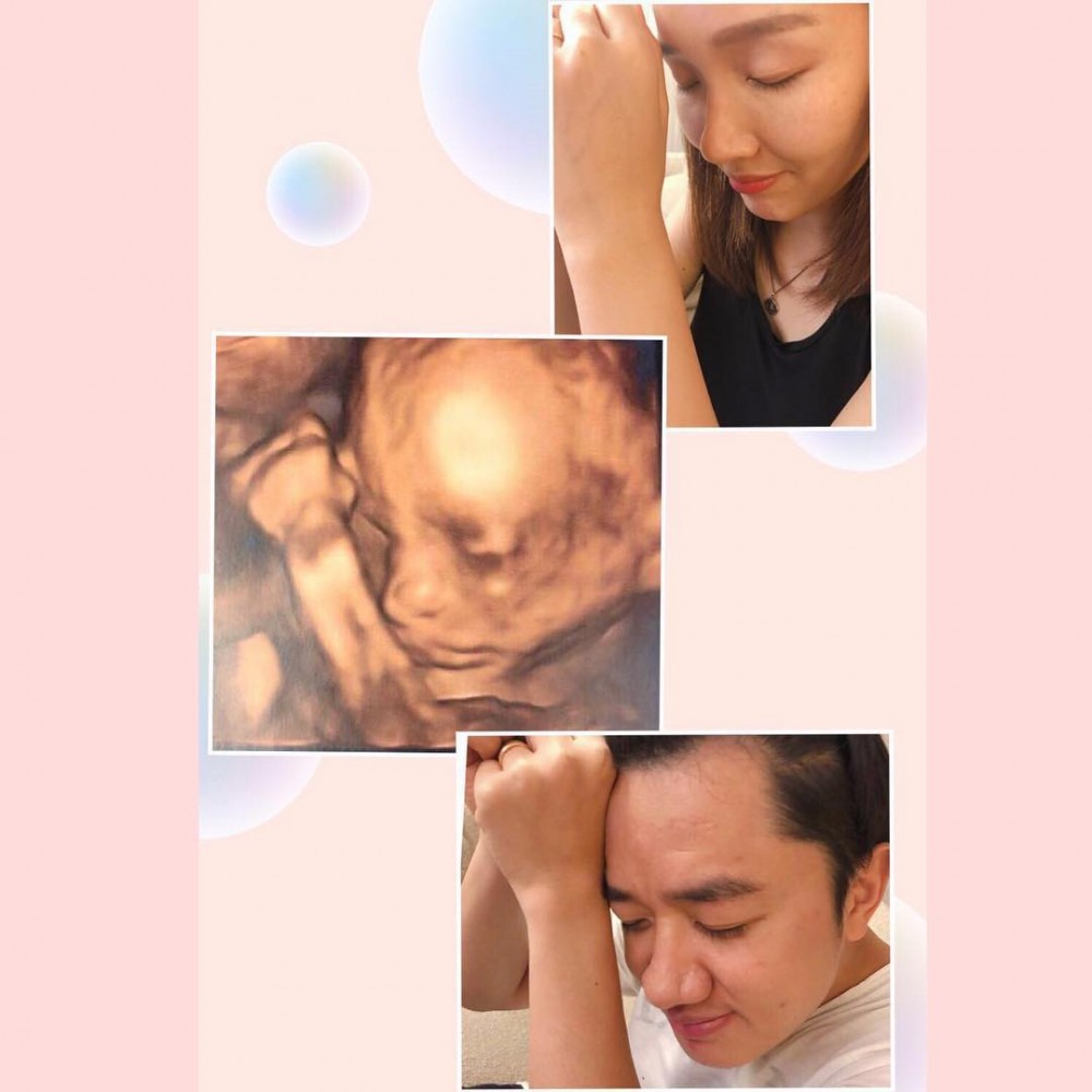 wong_cho_lam_44816194_2124637834464926_5287359716924757738_n