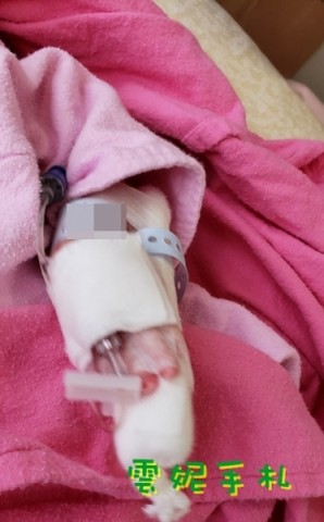 順產紀錄 - 種豆、打抗生素