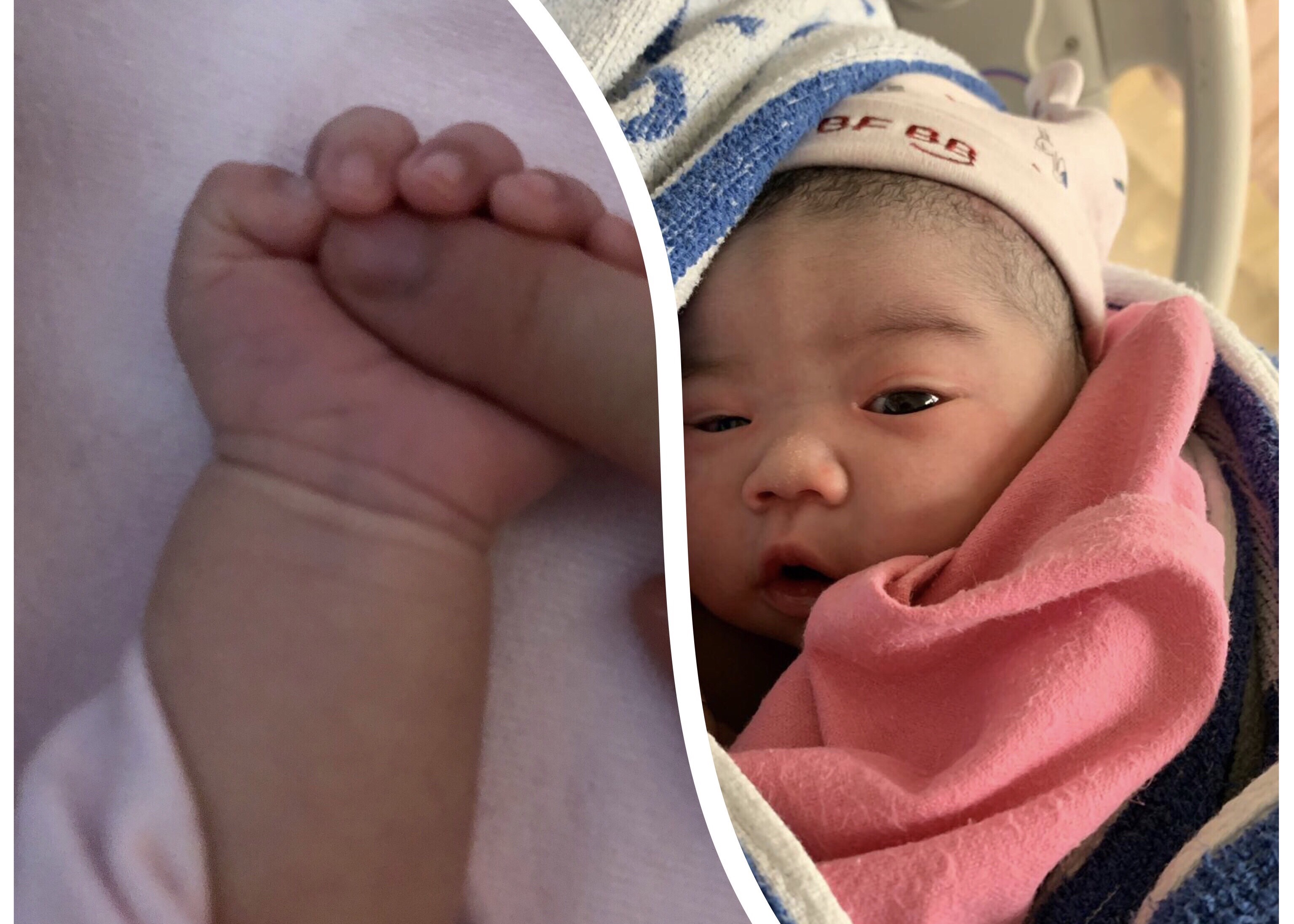 生產記錄 - 催生