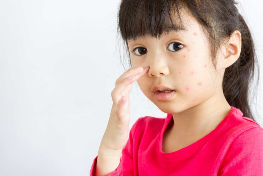 胃口欠佳、舌尖紅、舌頭上有泡泡(滋脷),有鼻涕、咳嗽、痰鳴音