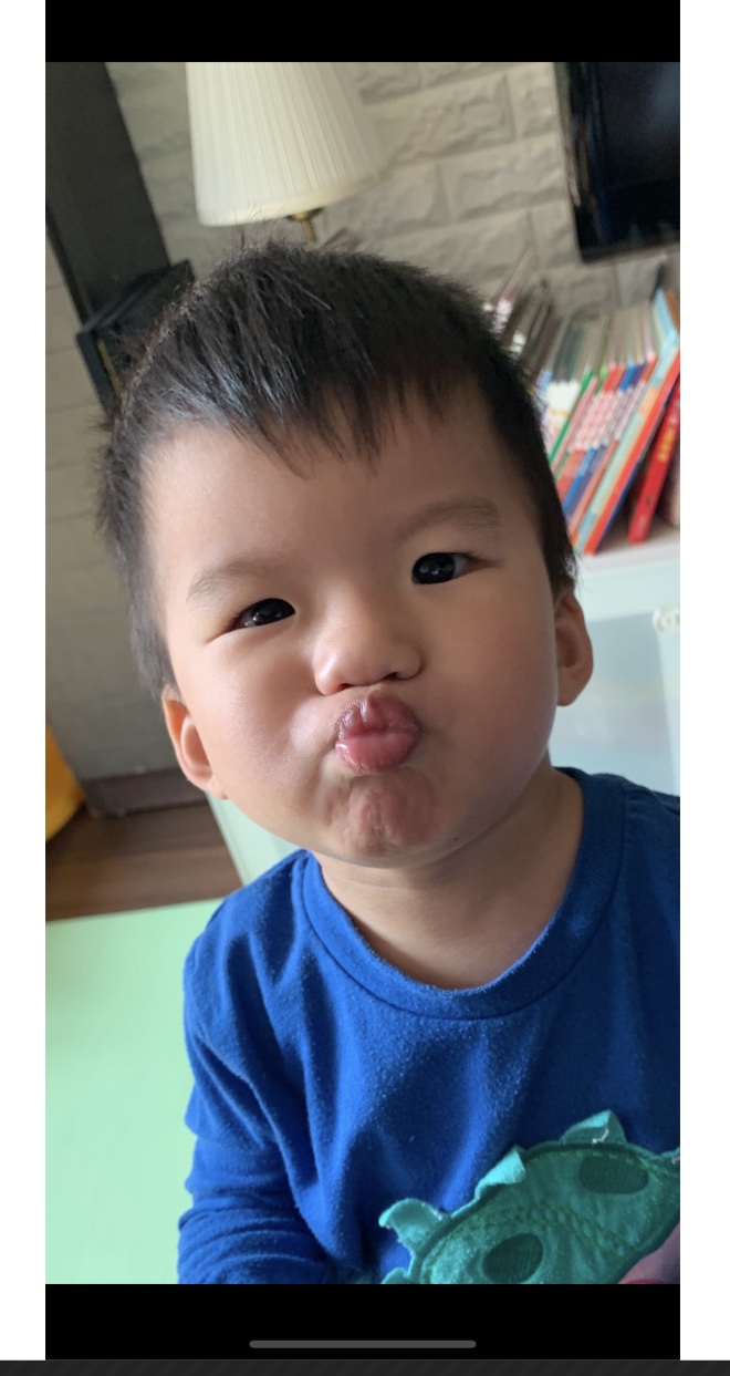 BB講嘢 - 發展遲緩?肌肉問題?特殊情況?