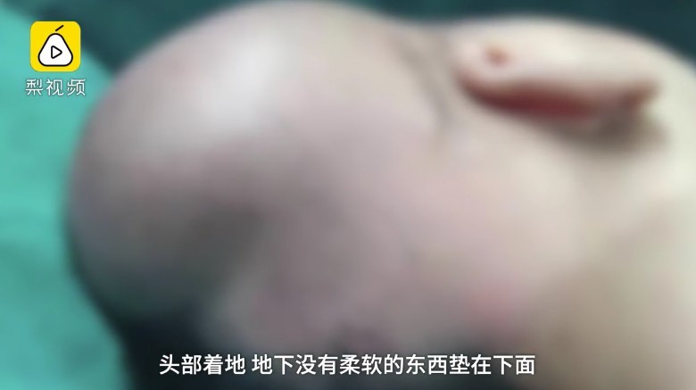 胎兒突然滑出