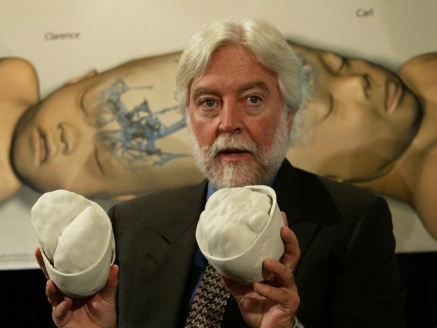 美國小兒神經外科權威、擅長顱骨連體嬰分離手術的古德里奇醫生（Dr. James T. Goodrich），於3月30日因感染新冠肺炎（武漢肺炎）病毒，不幸於紐約市布朗克斯的醫學中心去世。