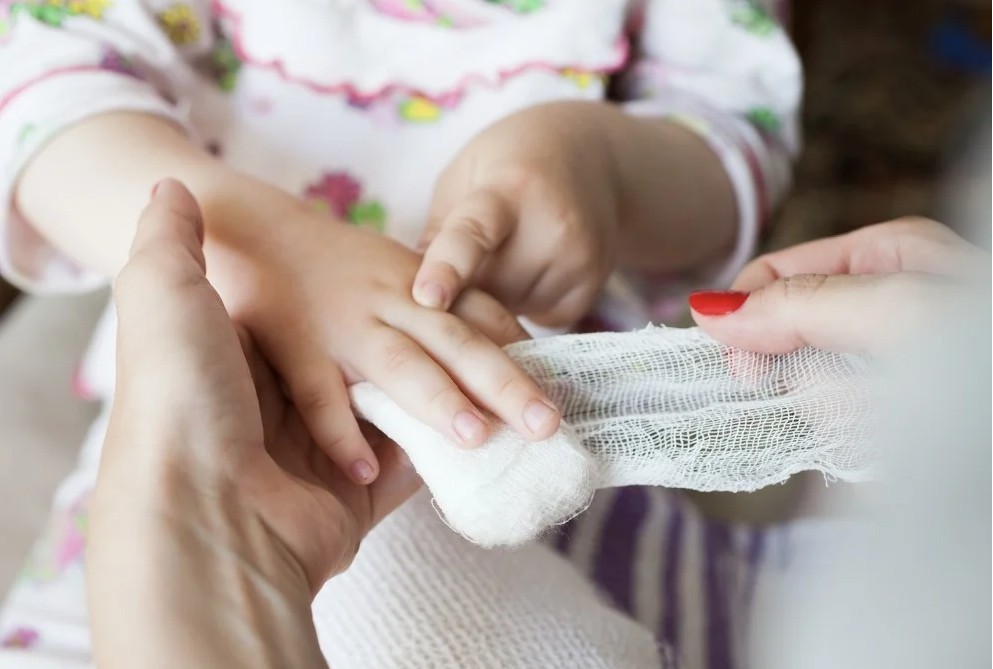 小朋友因為好奇容易受傷。