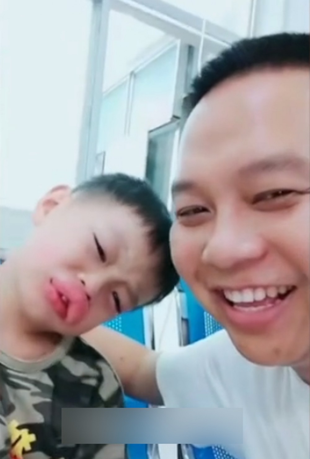 父親說雖然心疼兒子,但看到腫脹的嘴還是忍不住笑了。