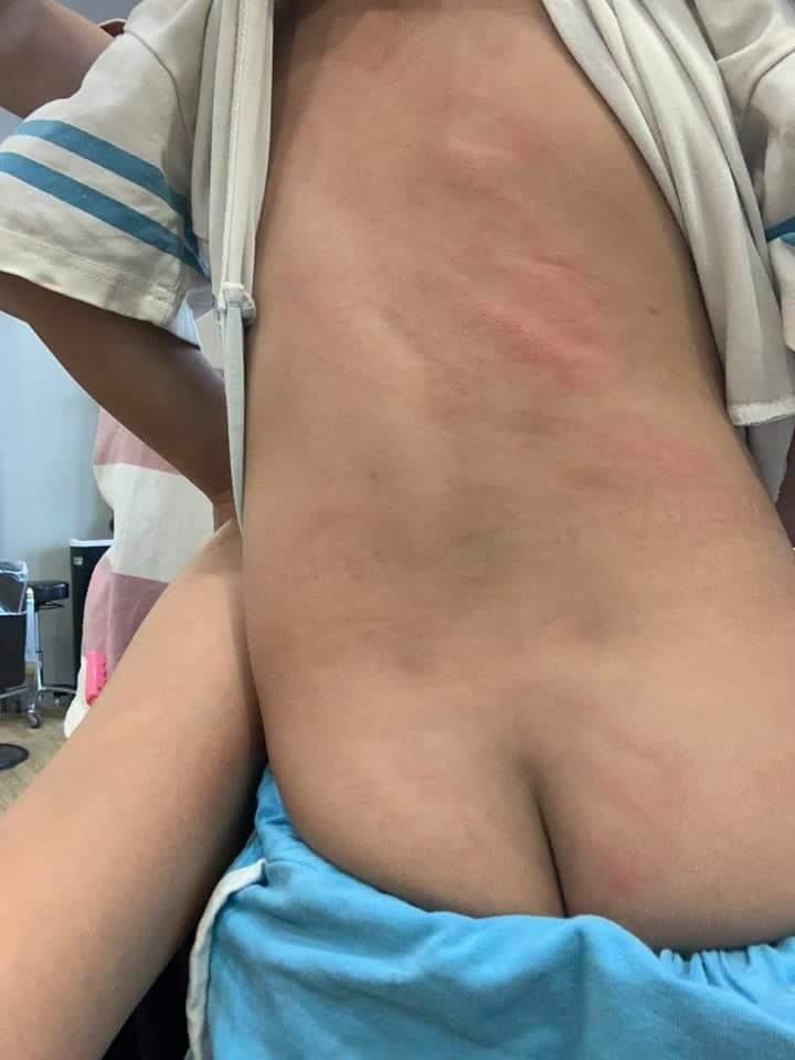 3歲幼稚園生不小心賴尿