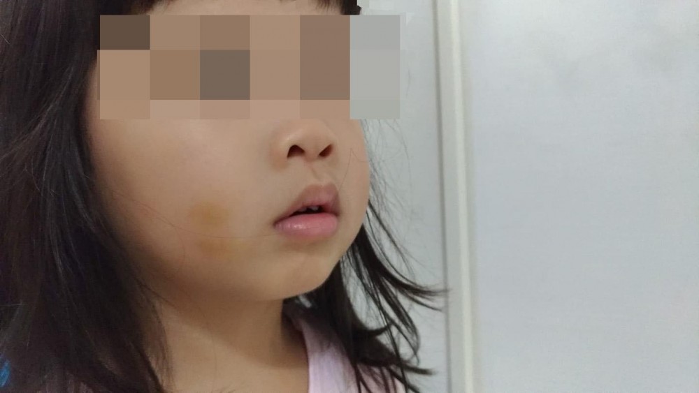 老師虐兒