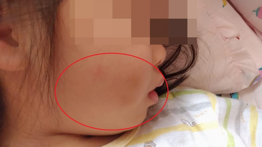 老師虐兒