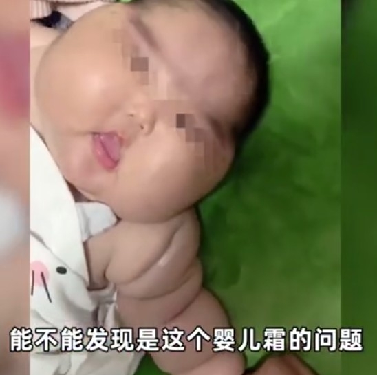女嬰。