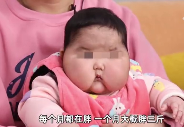 女嬰。
