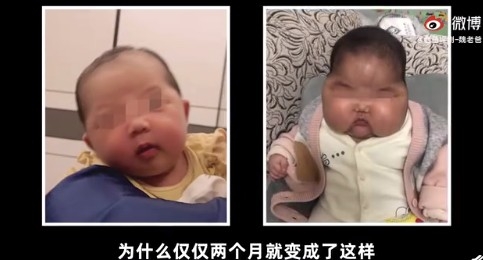 女嬰。