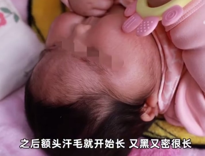 女嬰。