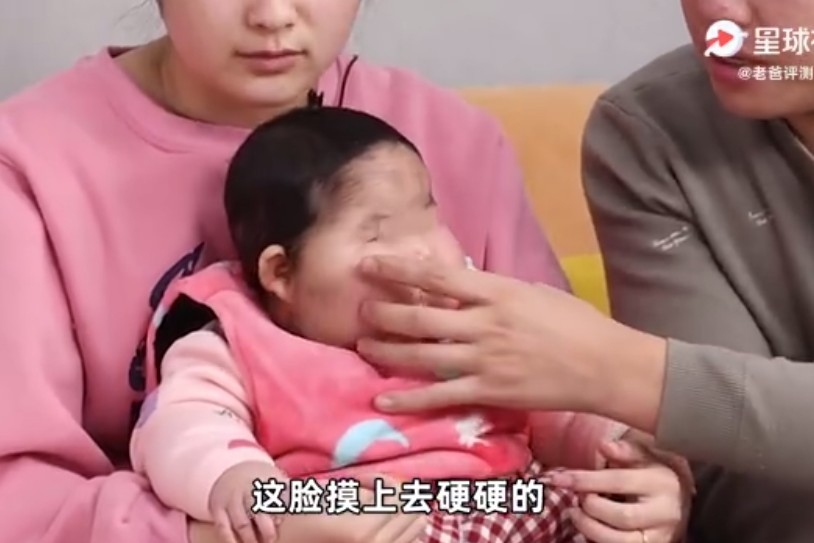 女嬰。