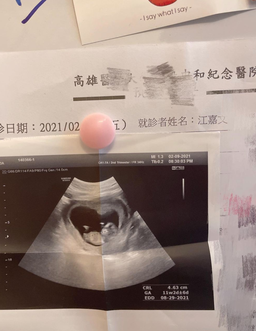 罔腰 IG