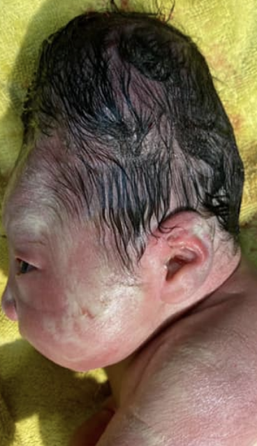 台北長庚醫院婦產科授權