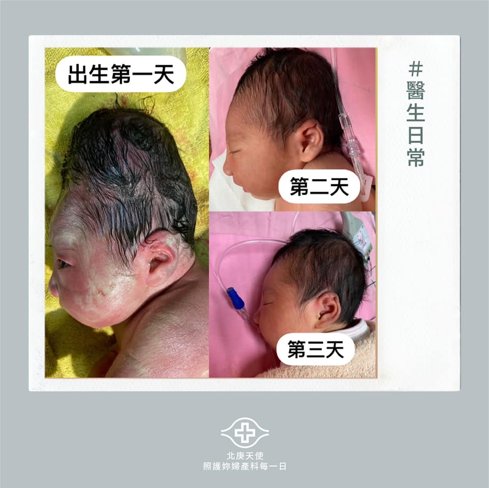 台北長庚醫院婦產科授權