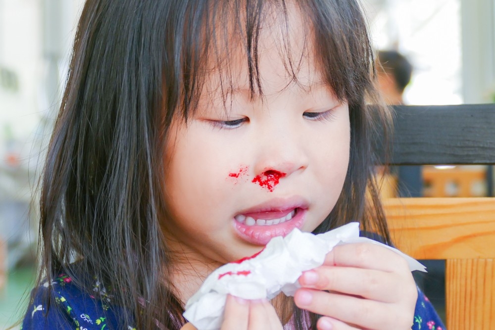 季節轉換、天氣乾燥、過敏性鼻炎等都會導致幼童流鼻血