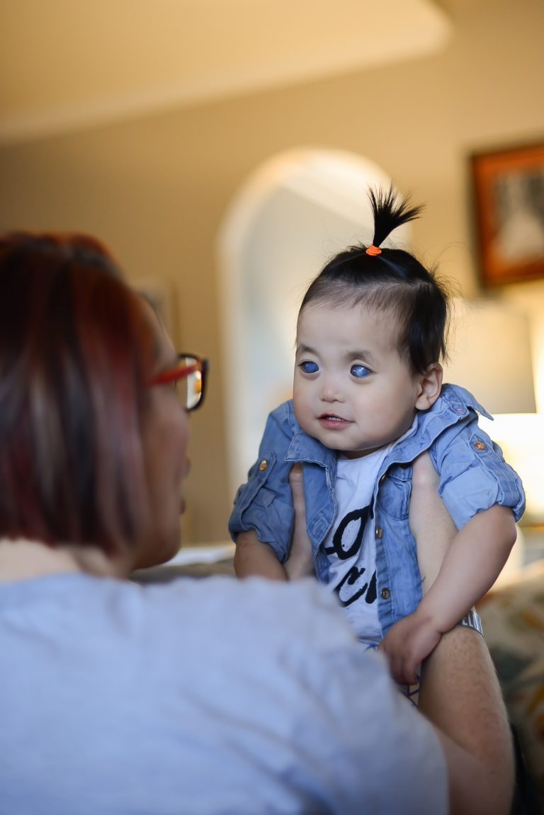 領養】擁銀藍眼睛被斥怪物更遭亞裔父母遺棄幸被領養改變人生, image size:768x1151