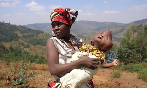 近日有團體為 Bajeneza 媽媽及她的幼子眾籌，希望可以籌得足夠醫藥費