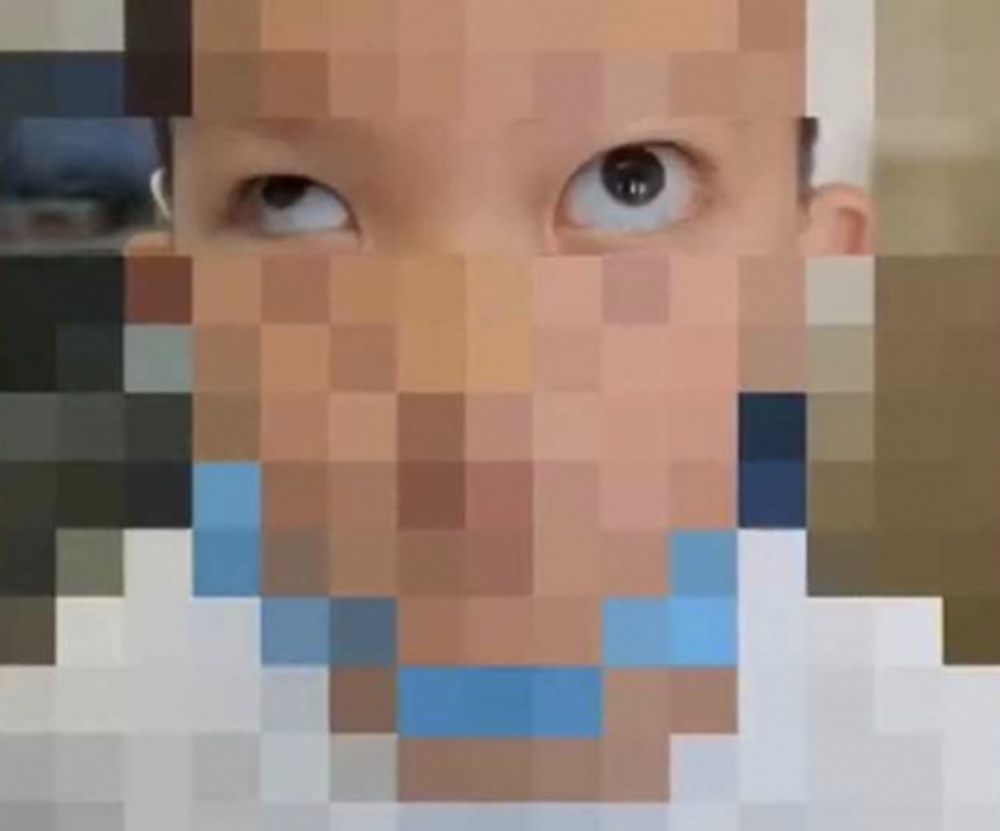早前在內地就曾經有位6歲男童,因模仿社交媒體抖音(TikTok)內的「凸眼」特效而徒手挖自己的眼球