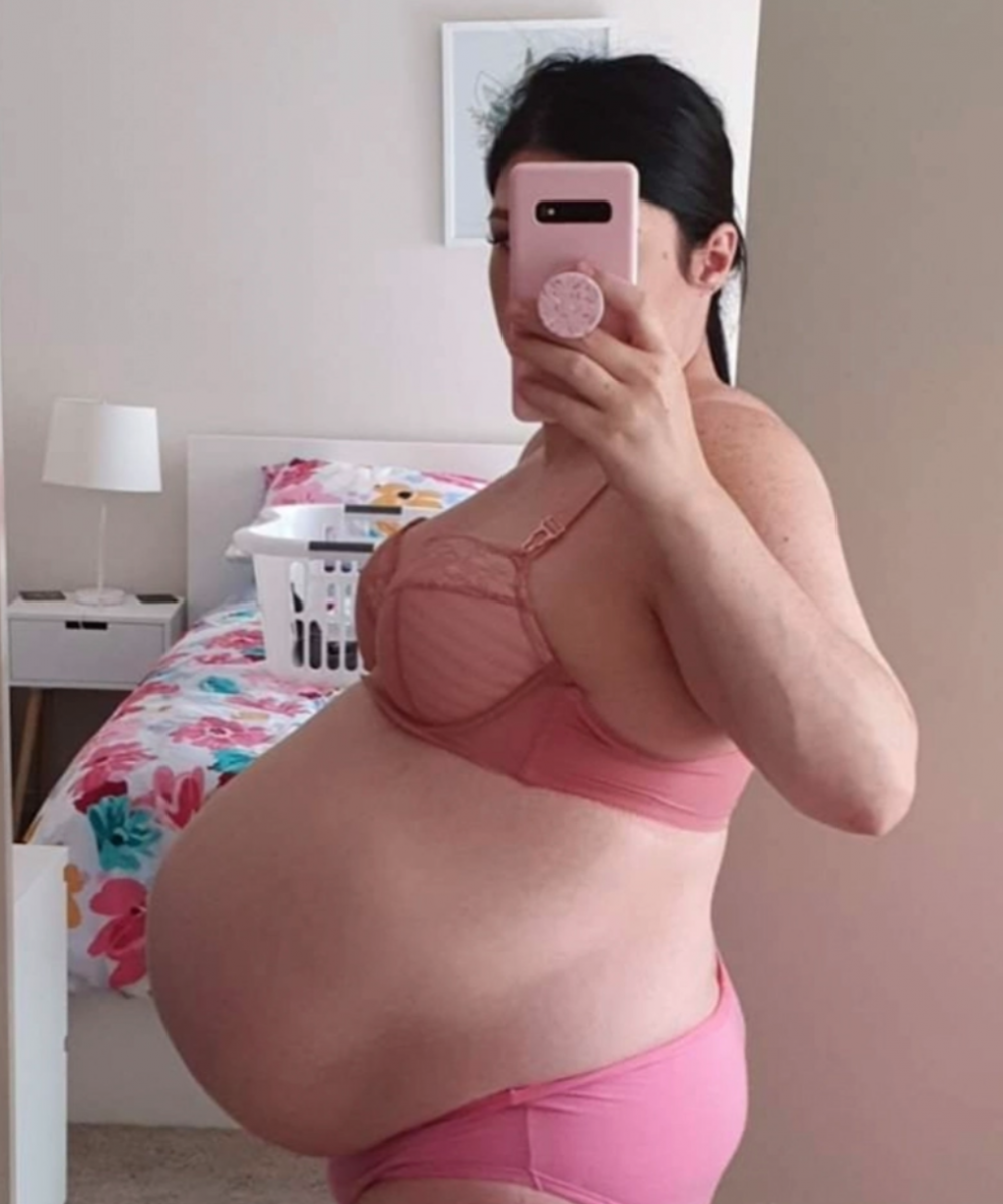 現年35歲的 Kimberley 因患有多囊卵巢症而被醫生告知不育,自幼渴望成為媽媽的她經過多輪試管嬰兒後終於成功懷孕