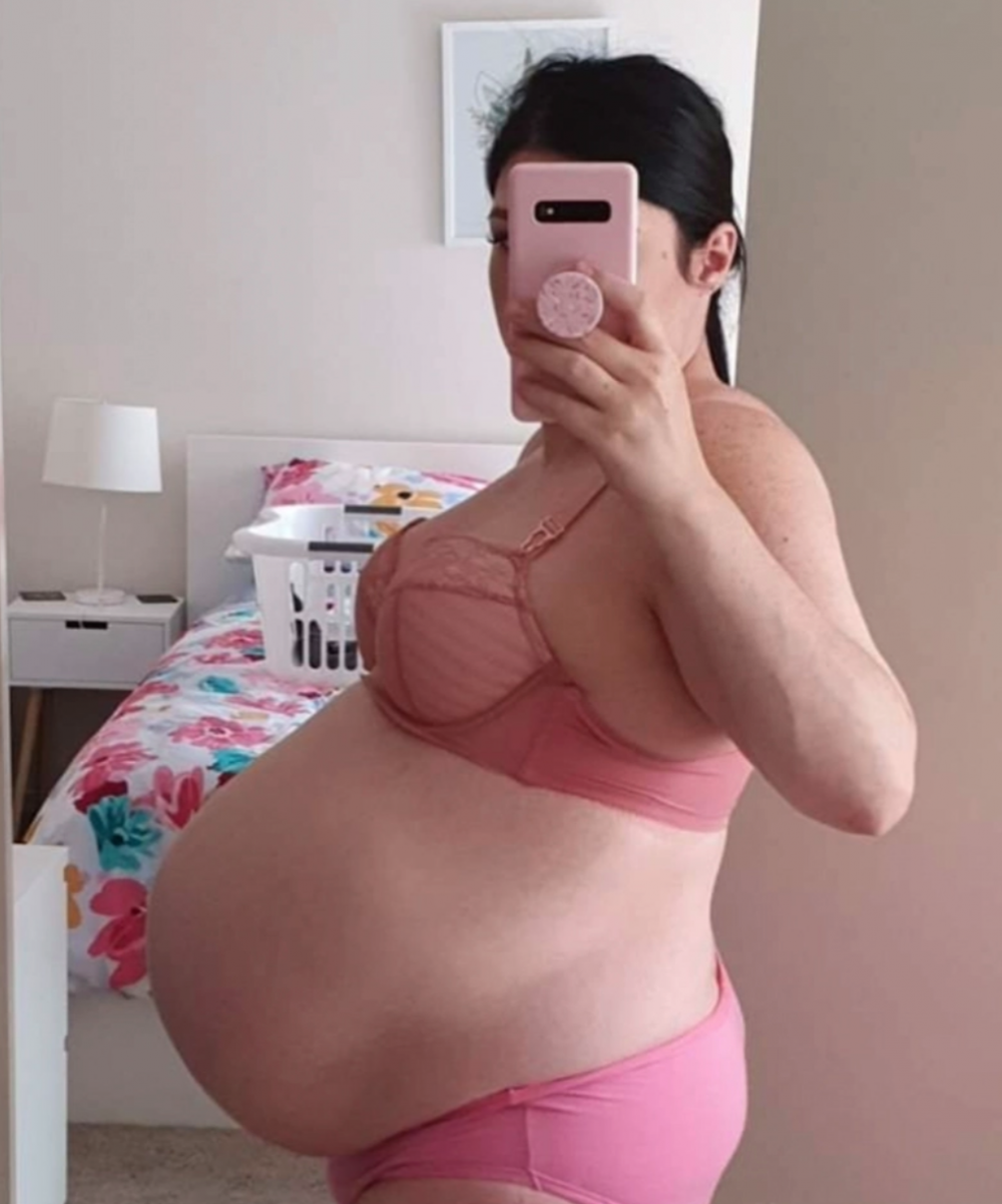 現年35歲的 Kimberley 因患有多囊卵巢症而被醫生告知不育，自幼渴望成為媽媽的她經過多輪試管嬰兒後終於成功懷孕