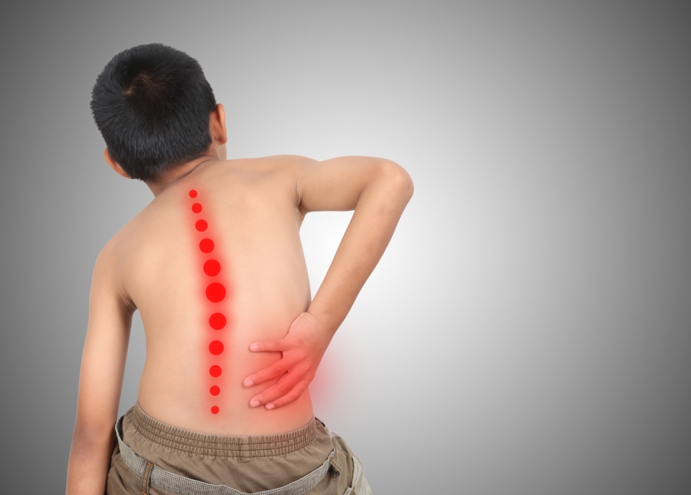 原發性脊柱側彎多出現於10歲左右。