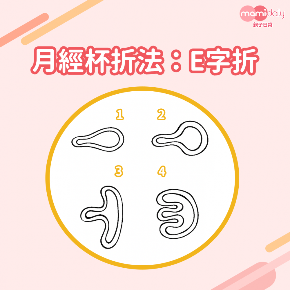 月經杯「E字折」圖解。