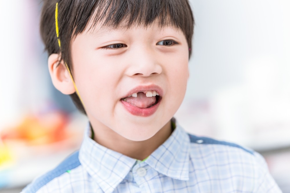 兒童在5歲或6歲開始,就會踏入換牙期。