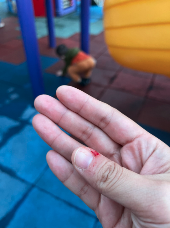 港媽在無護女兒期間，不慎被男童踢傷。