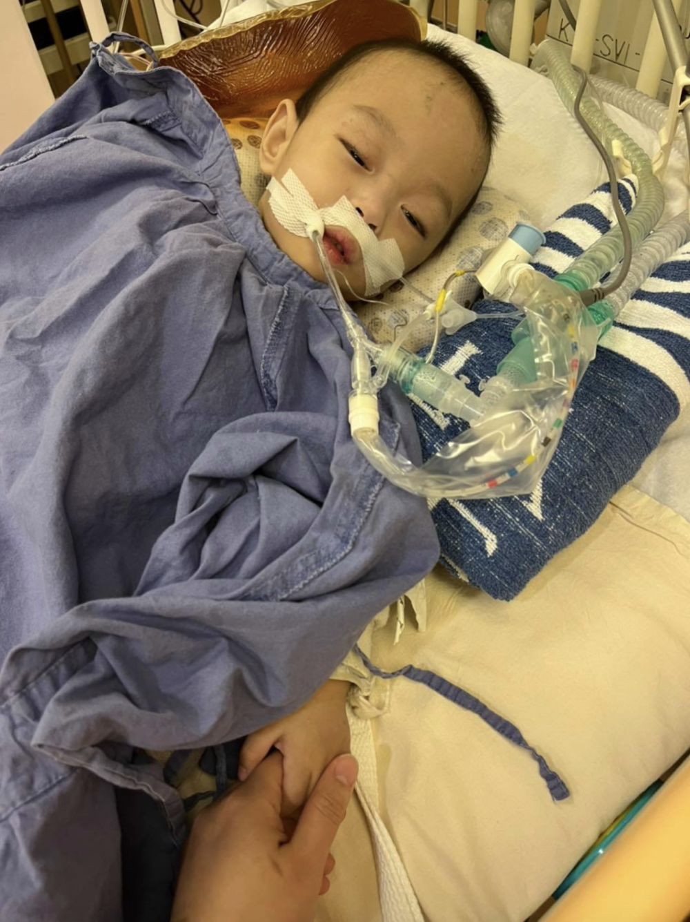 現年1歲多的早產BB信信患有肝臟纖維化,從出生開始就長期住院及經歷多次大小手術。