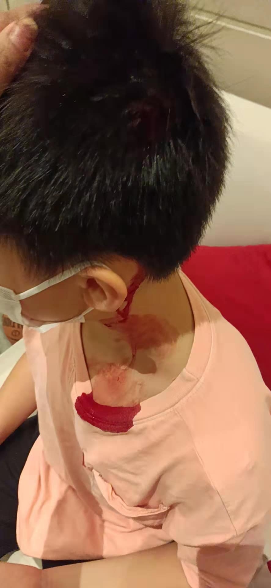 黃小姐的侄兒被另一名男童手持自製武器擊傷頭部，血流如注。