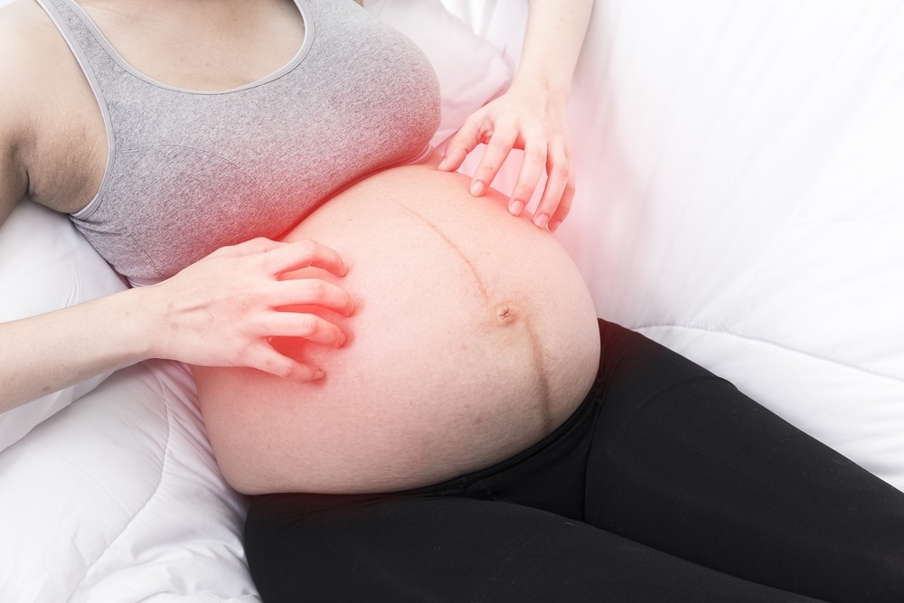 孕婦若是原本已經有妊娠紋，也可能導致妊娠紋部位發癢。