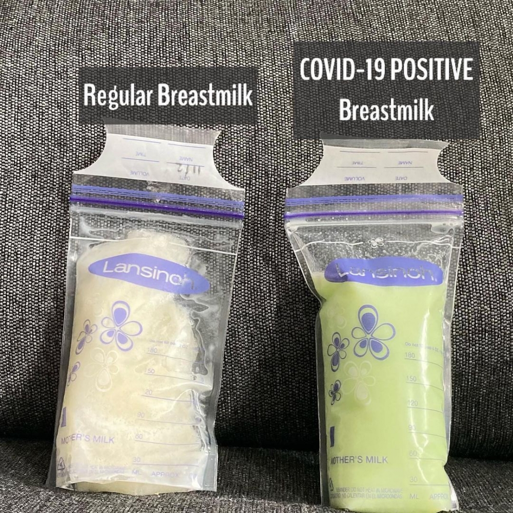 英國一名年輕媽媽Ashmiry在染疫後,母乳變成綠色。