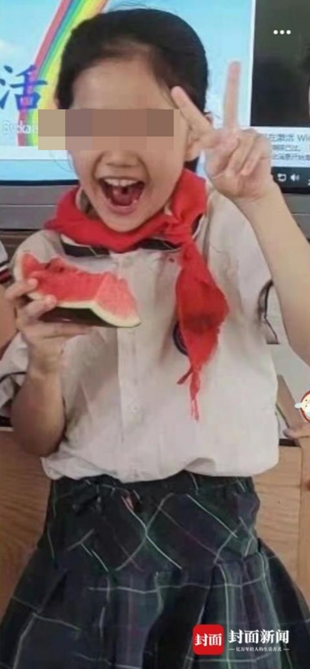 9歲女童被同學撞到腦出血不治。