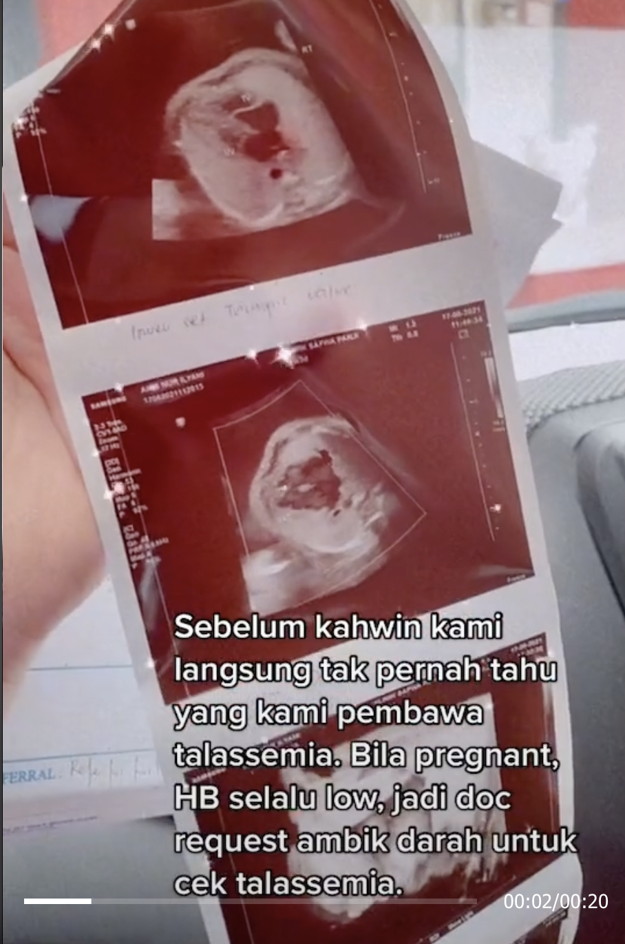 夫妻未進行婚前健康檢查,懷孕期間發現雙方都是地中海貧血症帶原者。