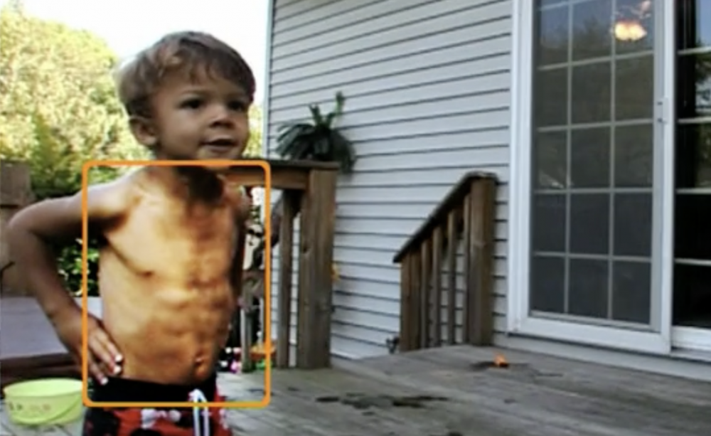 3歲時有6塊腹肌，被稱為「醫學奇蹟」。