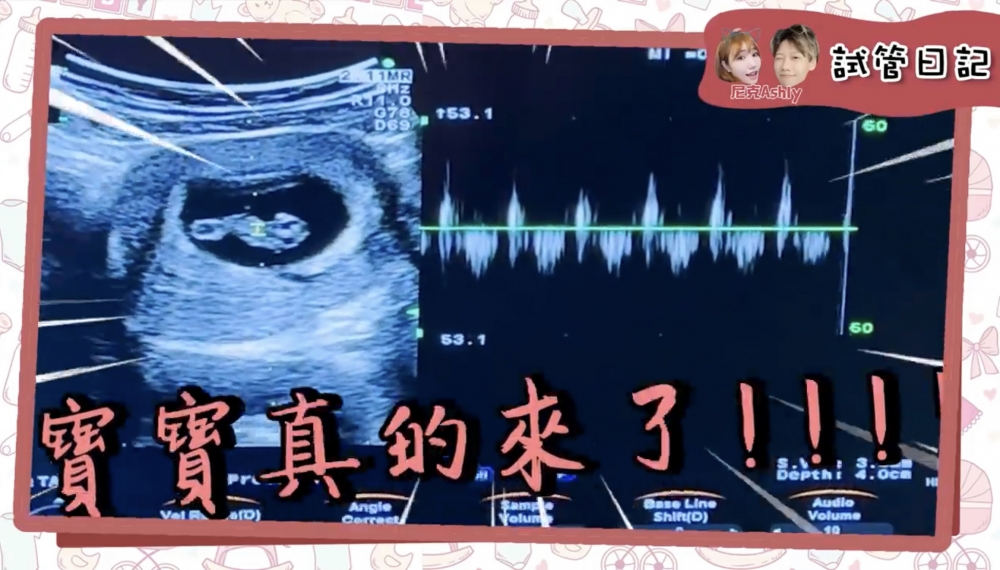 Ashly懷孕初期狀況佷不穩定,且害喜嚴重。