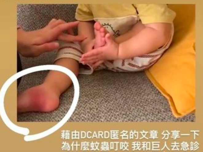 陳彥婷的兒子因遺傳媽媽體質,被蚊叮後會腫很大。