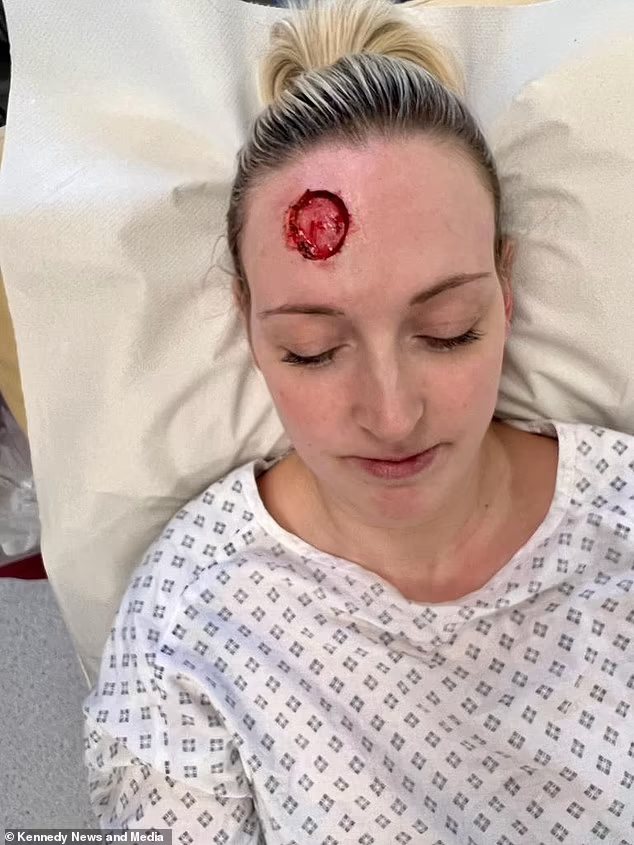 她認為手術過程恐怖。