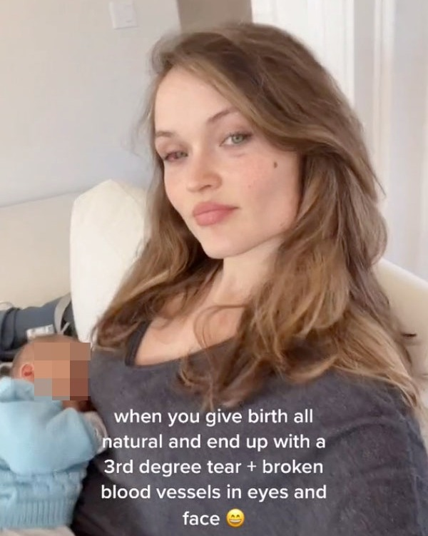 過了兩個星期左右，瘀血才完全褪去。