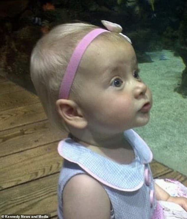 醫生表示胎記不影響健康，讓媽媽放下心頭大石。