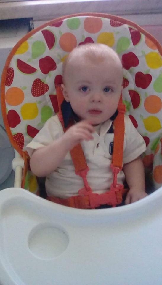 英國1歲男童誤吞猴子玩偶裡的鈕扣電池。