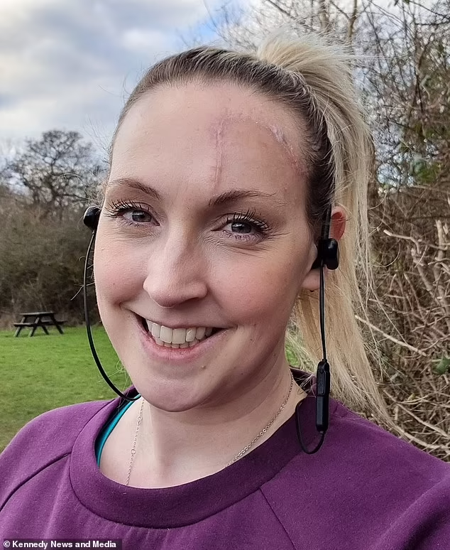 目前Rachael的疤痕已逐漸消褪。