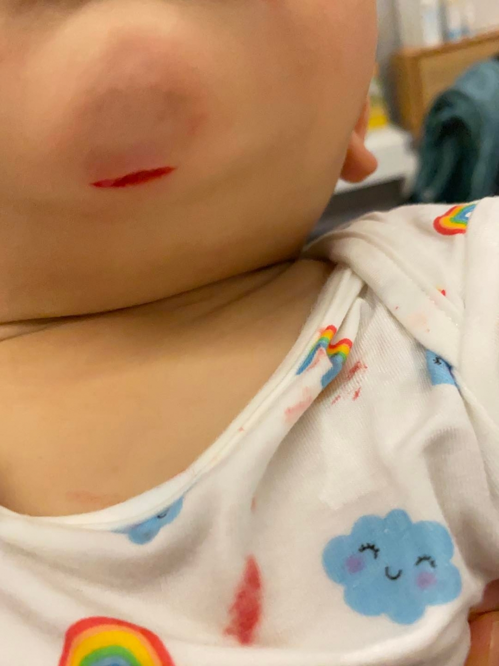 關宛珊因兒子受傷而嚇哭