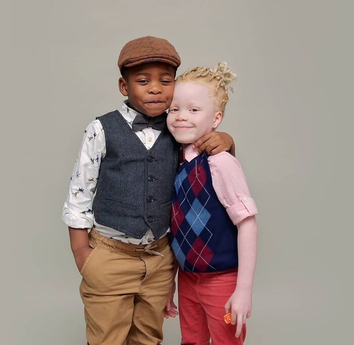 媽媽由最初很想女兒變回黑皮膚，至現在不希望女兒有任何改變。