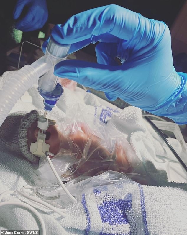 龍鳳胎因早產，有許多健康問題。