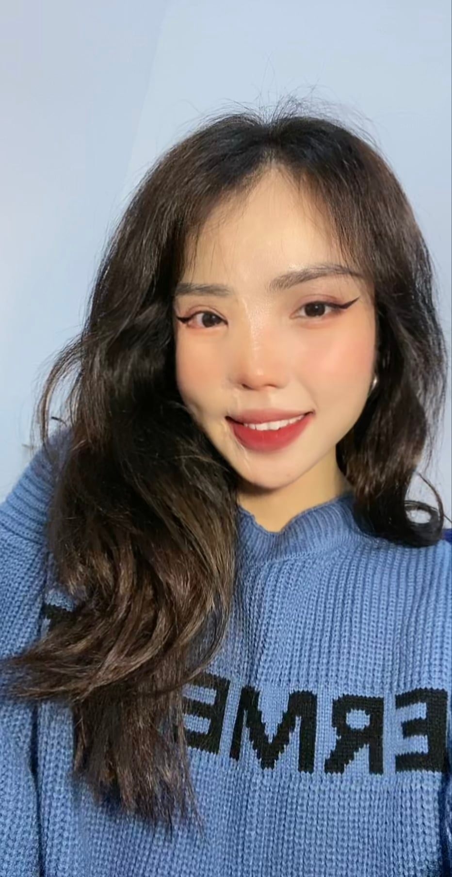 雖然臉上傷疤依舊，不過Vy已經恢復自信。