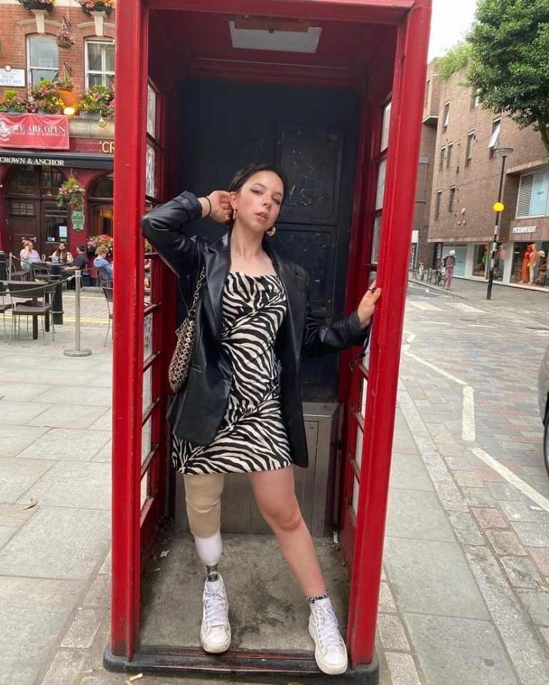 Iona平時也不懼怕展示自己的義肢。