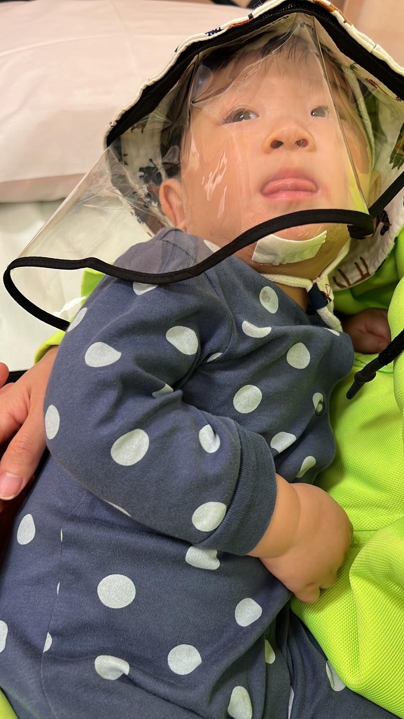 Preemo於家中跌傷下巴，需入院聯6針